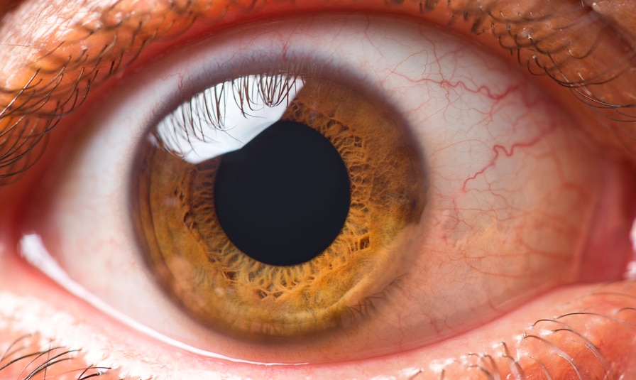 What You Need to Know About Eye Floaters
