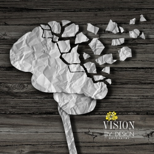 Concussion Treatment Edmonton - Vision by Design Optometry