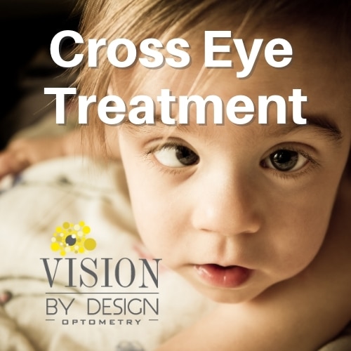 Strabismus (Cross Eyed) Treatment · Best Optometrist