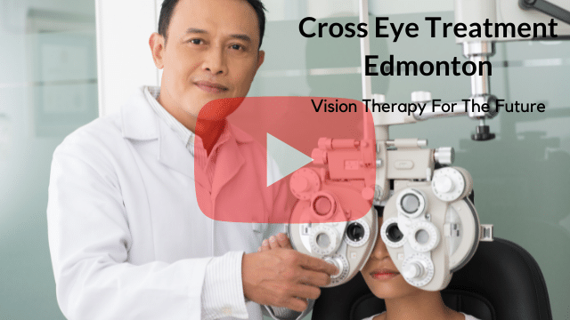 Cross Eye Treatment Edmonton