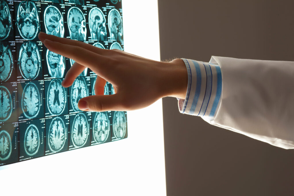 Concussion treatments and traumatic brain injury (TBI) scans