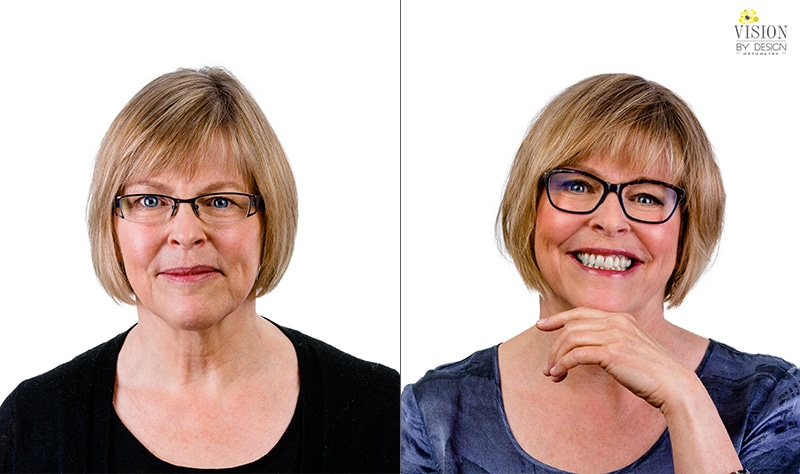 Before and after: Edmonton glasses makeover